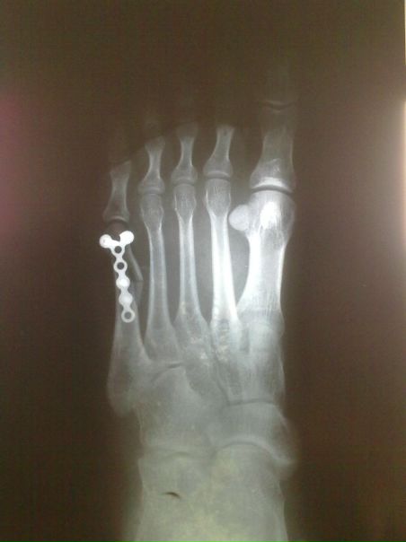 №20, Юлия Васькова, Ko Samui №20, Юлия Васькова, Ko Samui