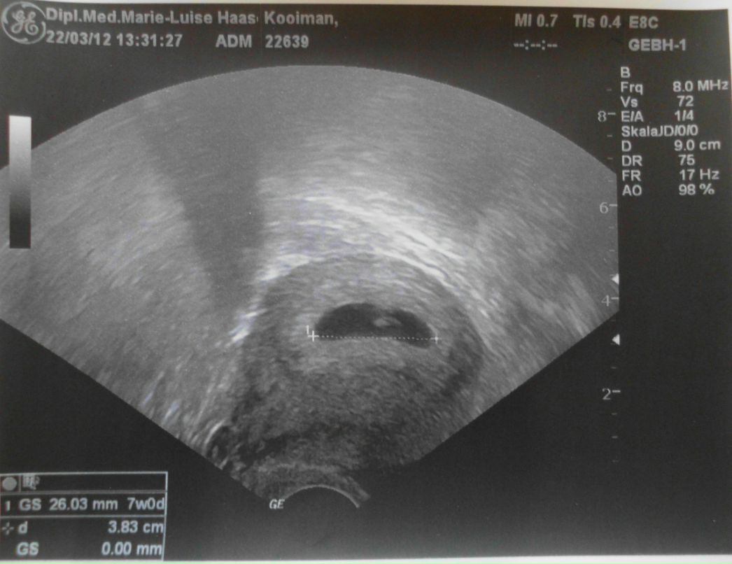 Ксения Койман | Schwerin