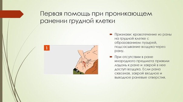 3 - На предплечье; 4 - на плечо; 5 - на плечо при его ранении